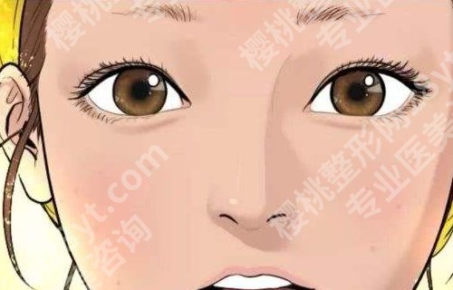 大连王琳做的双眼皮怎么样？案例更新、挑选医生经验曝光！