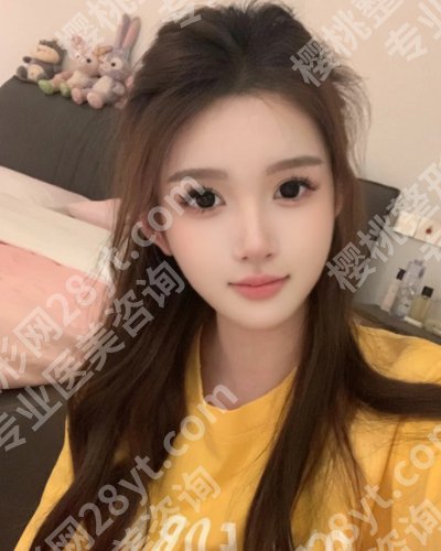 北京白志鹏做鼻子怎么样？技术在线！超全个人简介请查收！