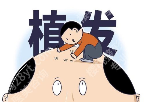 华中科技大学同济医院植发好吗？评价好！收费透明！实力推荐！