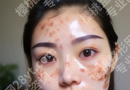 宜昌中心医院激光祛斑做的怎样？面诊细节问题已经发表
