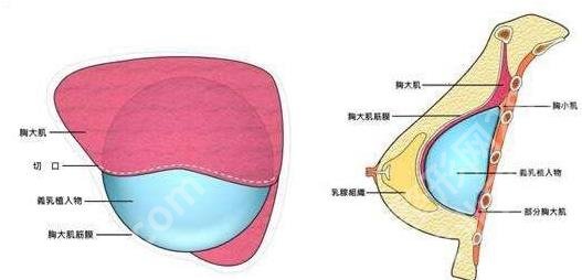 杭州做胸部整形哪家好？这几家医院备受欢迎！