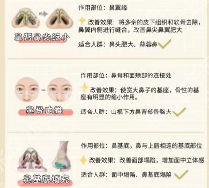 金柱翰鼻子多少钱？医生实力测评、擅长项目介绍！戳进来看