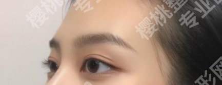 珠海人民医院双眼皮手术吗?医院亮点更新