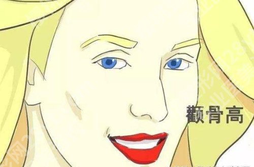 北京张笑天颧骨内推怎么样？医生介绍及案例更新！