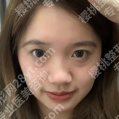 安徽省立医院祛疤哪个医生好?钟晓红、王强、王明刚人气暴涨!