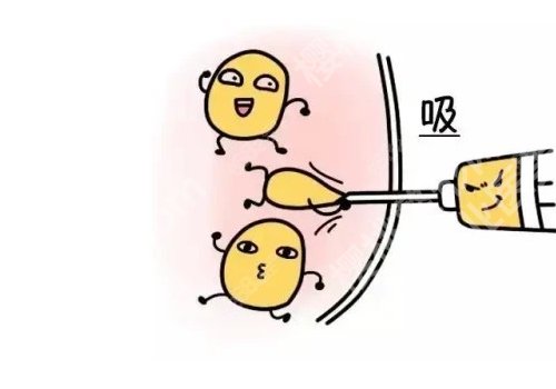 北医三院吸脂怎么样？医院亮点更新，实力在线分析！