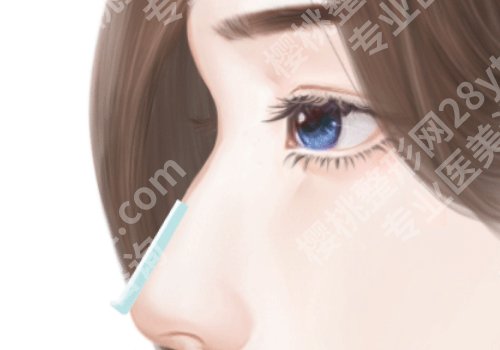 易曦做的鼻子怎么样？医生技术、口碑点评及真人案例分享