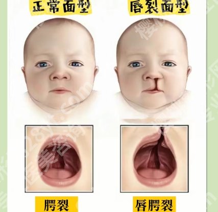 嘴唇整形手术价格贵不贵？科普篇等你了解