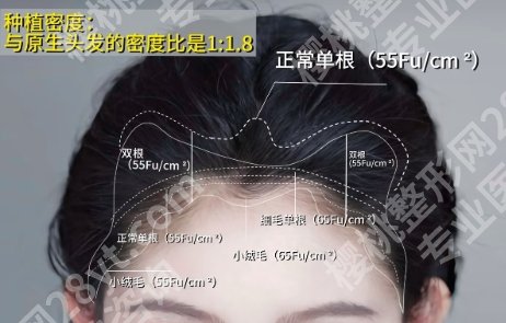 合肥植发正规三甲医院有哪些？看五家医院介绍