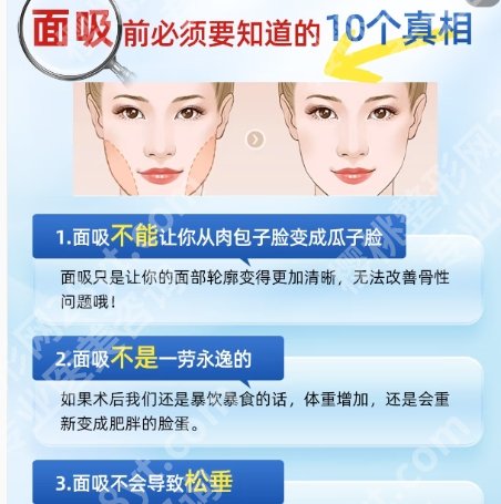 王世虎做面部吸要多少钱？价格贵不贵？价目表参考！