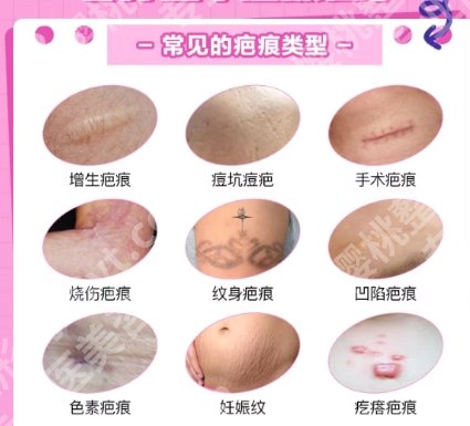 中山医美微整形医院不错的有哪几家？一键查看医院名单