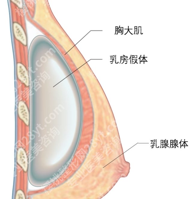 长沙做隆胸哪里医院好？戳进来看真实的顾客点评吧！