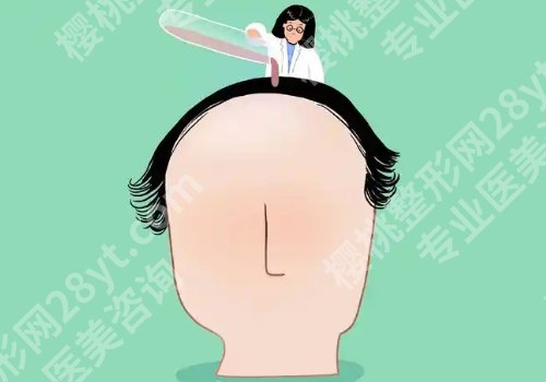 杨娟敏医生植发怎么样？技术靠谱吗？案例一览！