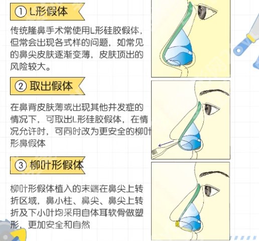 北京八大处做鼻子好的医生:于晓波、宋维铭还可以，附面诊攻略及案例鉴赏！