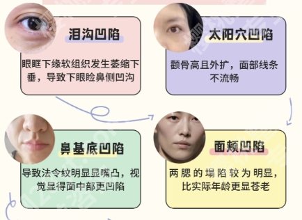 上海九院鼻基底多少钱？医院实力点评|鼻基底案例图反馈！