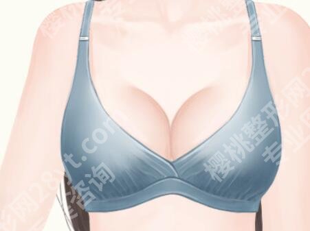 上海第九人民医院丰胸手术费用是多少？丰胸价格为1万元起