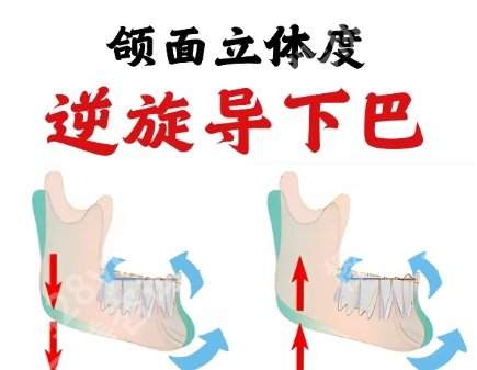 首口颏成型费用贵不贵？全新收费标准更新！戳进来看