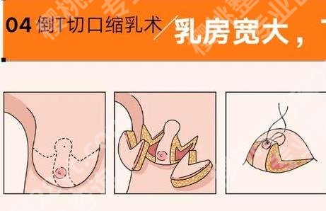 南京美莱夏建军个人介绍|坐诊医院及擅长项目科普