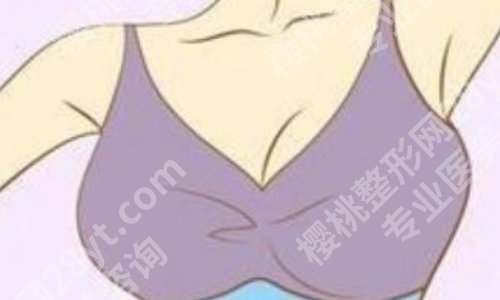 九院曹卫刚脂肪隆胸多少钱？低至于2万元起，坐诊医院曝光！