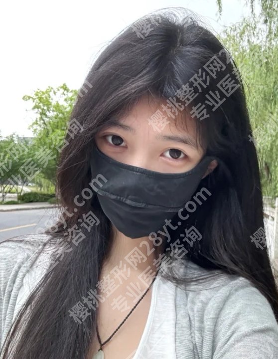 医学科学院整形外科医院植发费用是多少？低至10000元起！附优势信息！