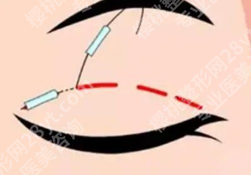 宁波整形外科医院是公立医院吗？详情来袭、医生实力曝光！