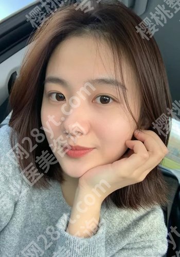 李学拥割双眼皮做的怎么样？技术及口碑点评在线！