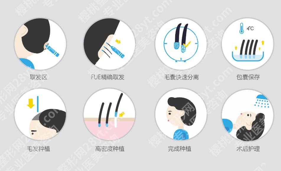 延吉植发多少钱？如何选择医院？植发术后tips分享！