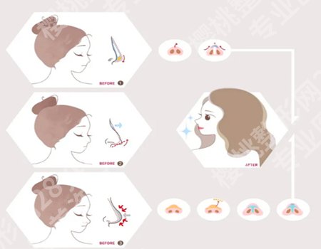 上海管果医生的口碑评价如何？附点评_详细案例优选啦