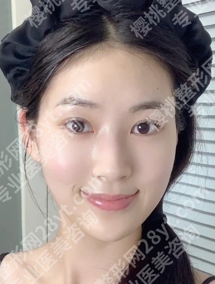 袁玉坤医生做脂肪填充怎么样？医生实力在线！内附新版价格表！
