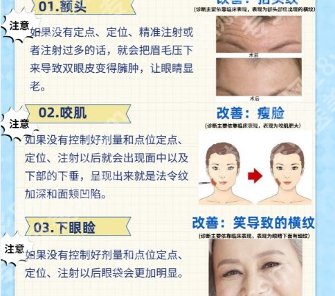 北京协和医院筋膜悬吊怎么样？医院实力点评|案例图反馈！