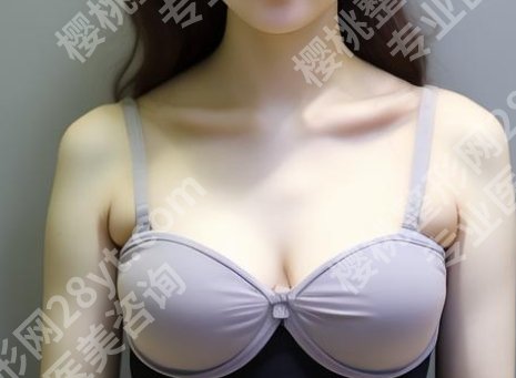 南方医院隆胸需要多少钱?医院做隆胸优势有哪些?附案例