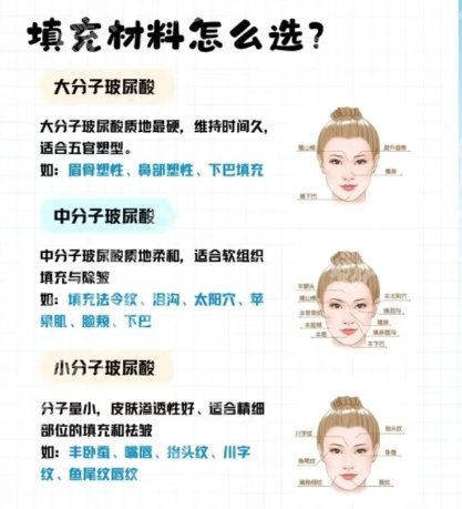 深圳北大医院打玻尿酸脸颊多少钱?注射填充案例鉴赏!