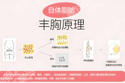 付苏医生做乳头缩小手术好吗？案例点评和分享一一查看