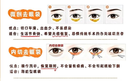 姜平医生做眼袋案例！附真实口碑点评来袭！收藏再看！