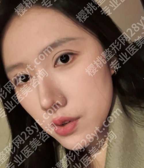 北京空军总医院美容整形中心双眼皮怎么样？附科室资料、项目介绍！
