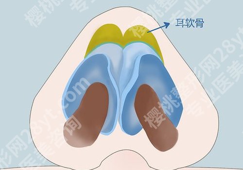 广州郭栋做鼻子怎么样？医生介绍、技术特色更新！