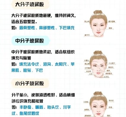 上海长征医院垫下巴多少钱？医院资料段鸥办法|价目表一览！