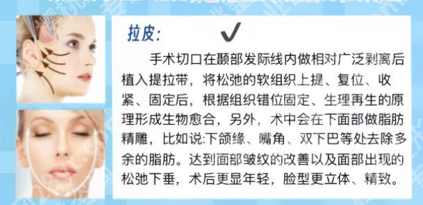 协和拉皮手术做的好吗？拉皮手术案例曝光！