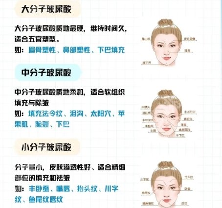 浮想国美容医院怎么样？医院资料及真人填充案例图反馈！