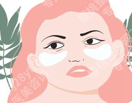 余力医生去眼袋的原因分析,去眼袋案例分享,个人资料公布