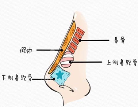 李东医生做鼻子怎么样？隆鼻案例全过程分享，咨询术前必看