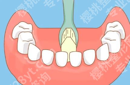 上海新华医院正畸多少钱?金属托槽矫正10550元起