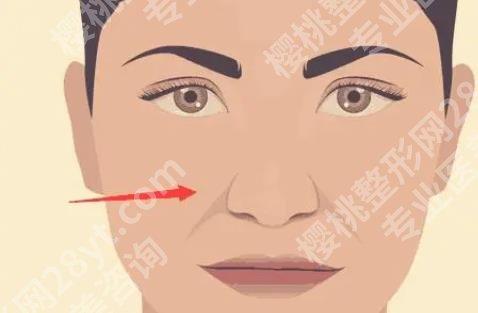 黄寅守拉皮价格贵不贵？坐诊医院及拉皮项目案例分享！