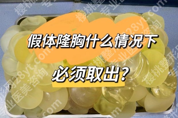 北京八大处假体隆胸取出价格25年更新，技术优势_真人案例曝光！