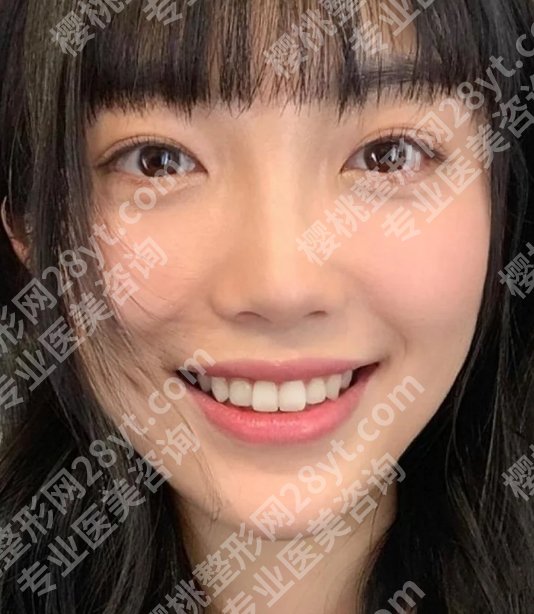 杨浦区中心医院双眼皮价格是多少?低至4000元起,附医生简介!
