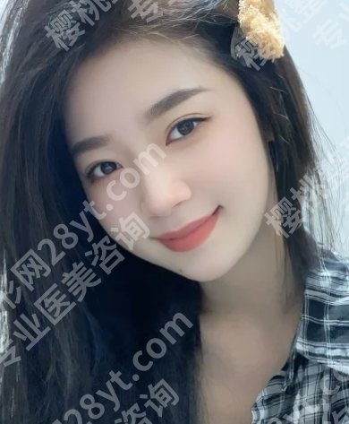 季滢医生筋膜提升怎么样？技术实力在线！优势公布！