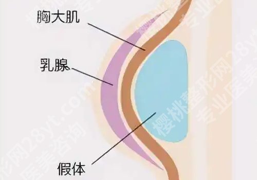 张海林医生口碑点评更新！医生简介、术后小tips等曝光！
