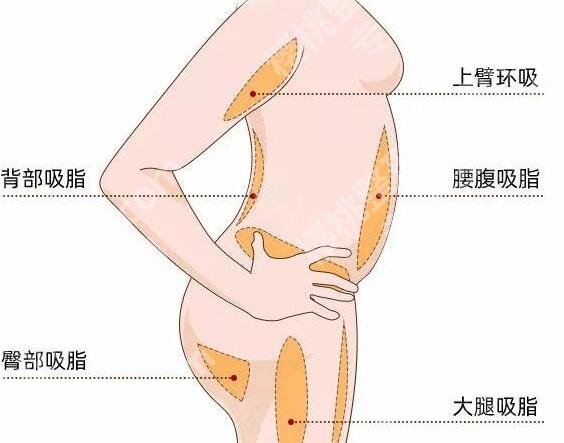 曹卫刚抽脂费用是不是很高？公布价格列表与医生资料分享