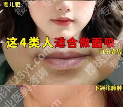 上海徐宇红医生面部整形咋样啊?面诊过程及医生选择经验get!