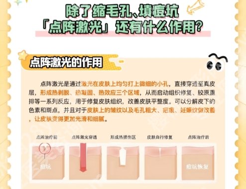 小榄人民医院点阵激光多少钱？分享资料信息！点击收藏